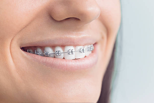 Best Invisalign and Clear Aligners  in Home Gardens, CA